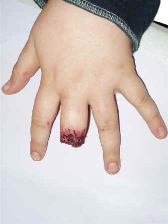 Special_Effects_Finger2.JPG (70516 bytes)